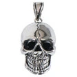 Louis Skull